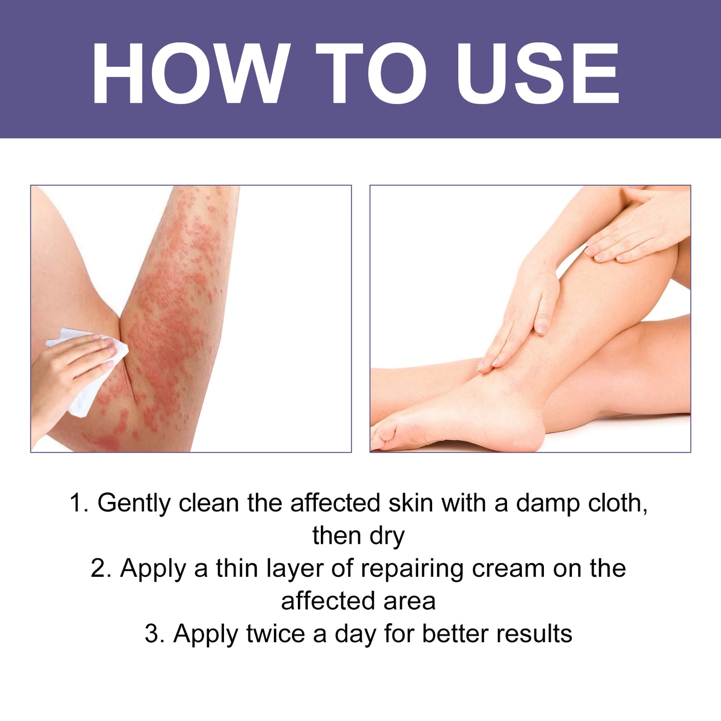 3 Days Aati Fungal Rash Cream, Repair Skin Barrier Soothe Moss Redness And Itchiness Moisturizing Skin Care Cream